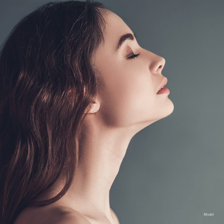 Model's face after Kybella treatment
