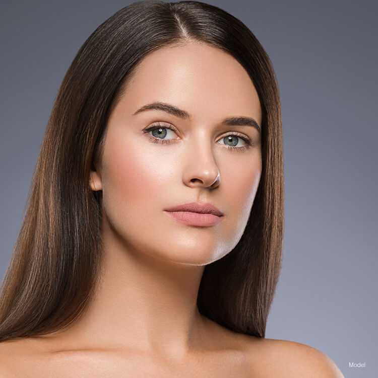 Model after a restylane injectable filler