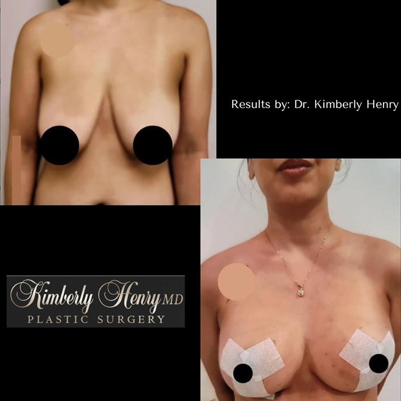 Instagram Before and After Results Post