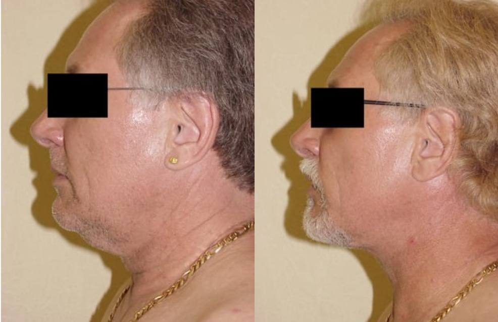 Actual patient results 2