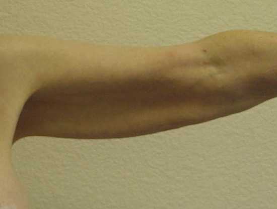 Case--6341 | Before Body