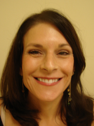 Brow-Lift-Case--4737 | After Face