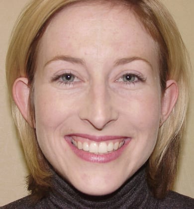 Case--8934 | Before Face