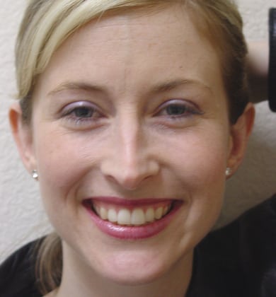 Case--8934 | After Face