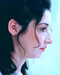 Rhinoplasty-Case--6282 | Before Rhinoplasty