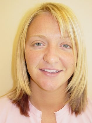 Case--1393 | Before Rhinoplasty