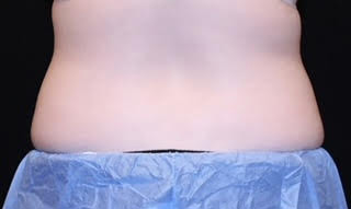 Case--5640 | Before Body