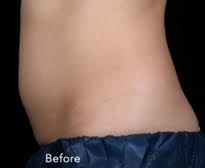 Case--4385 | Before Body