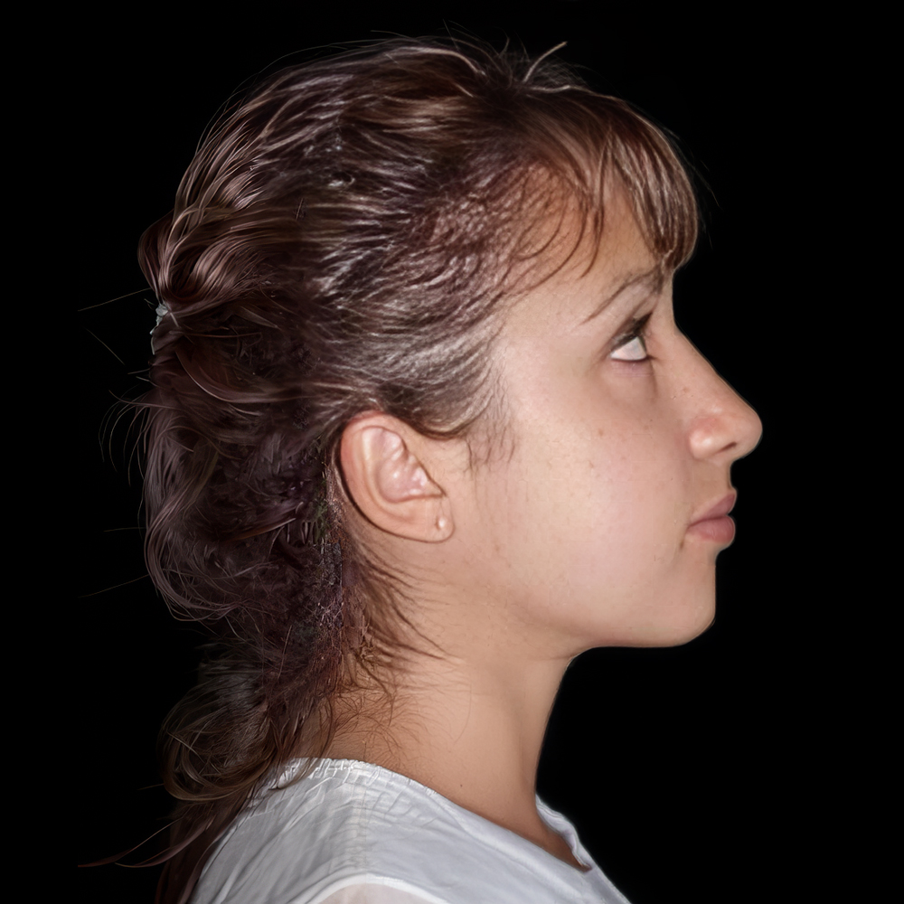Patient before treatment