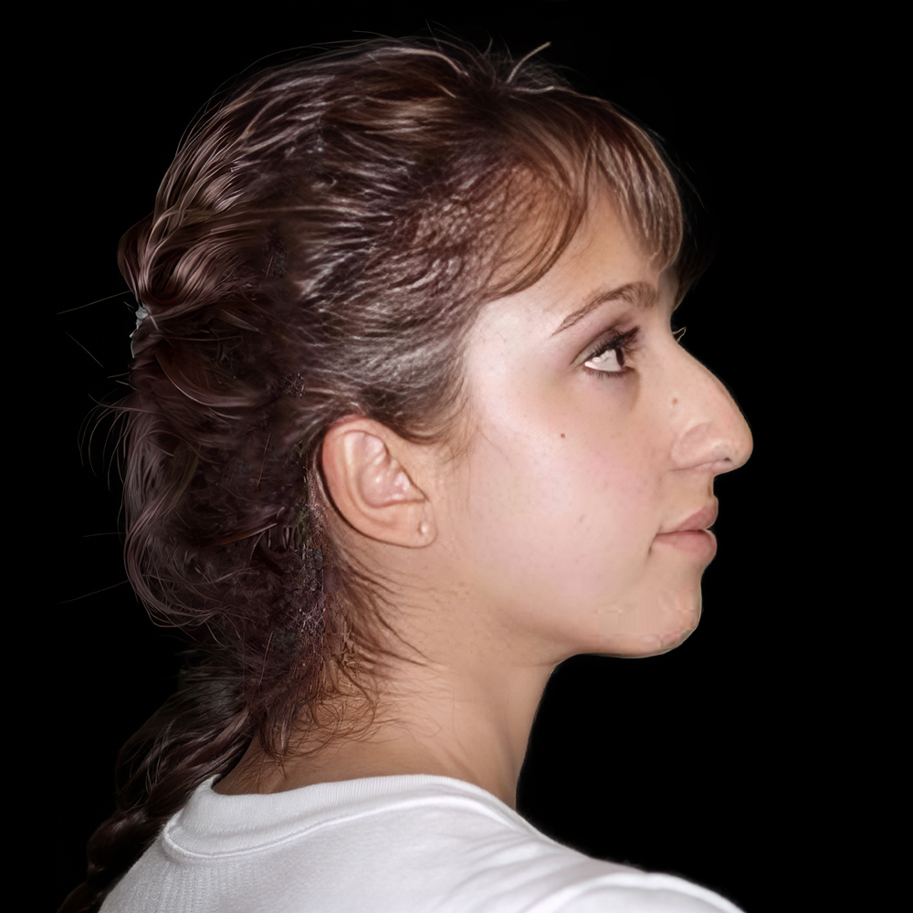 Patient after treatment