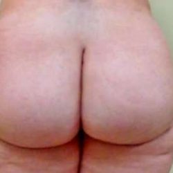 Brazilian Butt Lift Before & After Patient #1062