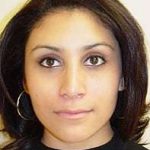 Rhinoplasty Before & After Patient #263