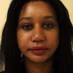 Brow Lift Before & After Patient #431