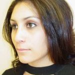 Rhinoplasty Before & After Patient #263