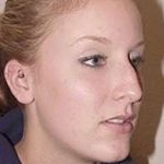 Rhinoplasty Before & After Patient #188